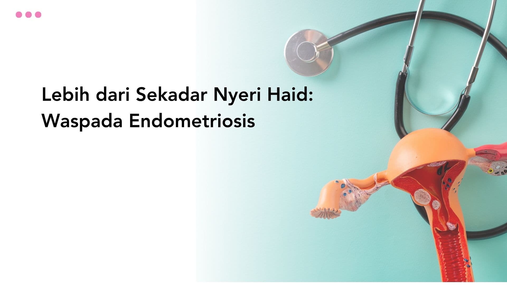 Lebih dari Sekadar Nyeri Haid: Waspada Endometriosis