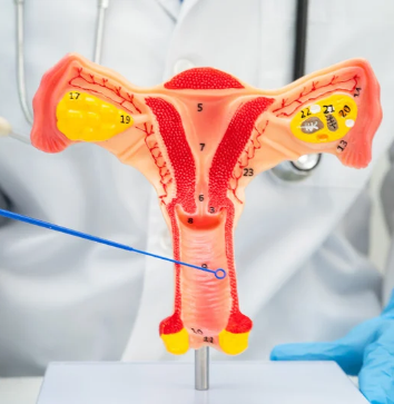 Keputihan pada Wanita: Kenali Ciri Normal dan Tidak Normal, serta Kapan Harus ke Dokter